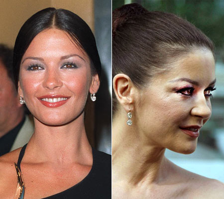 Foto: Getty Images e reprodução Daily Mail