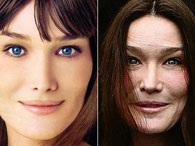 Veja famosas que fizeram plástica e ficaram piores do que antes