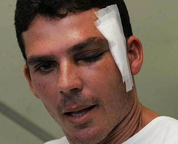 Alessandro Costa / Agência O DIA