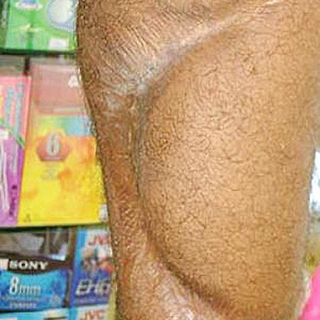 Foto: Bruno Trigueiro / Especial para o Terra
