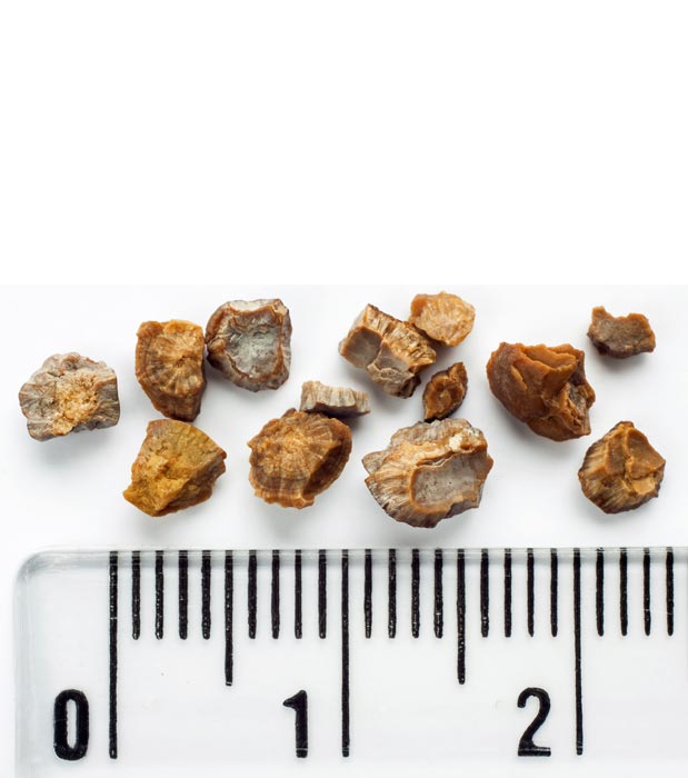 piotr_malczyk/iStock